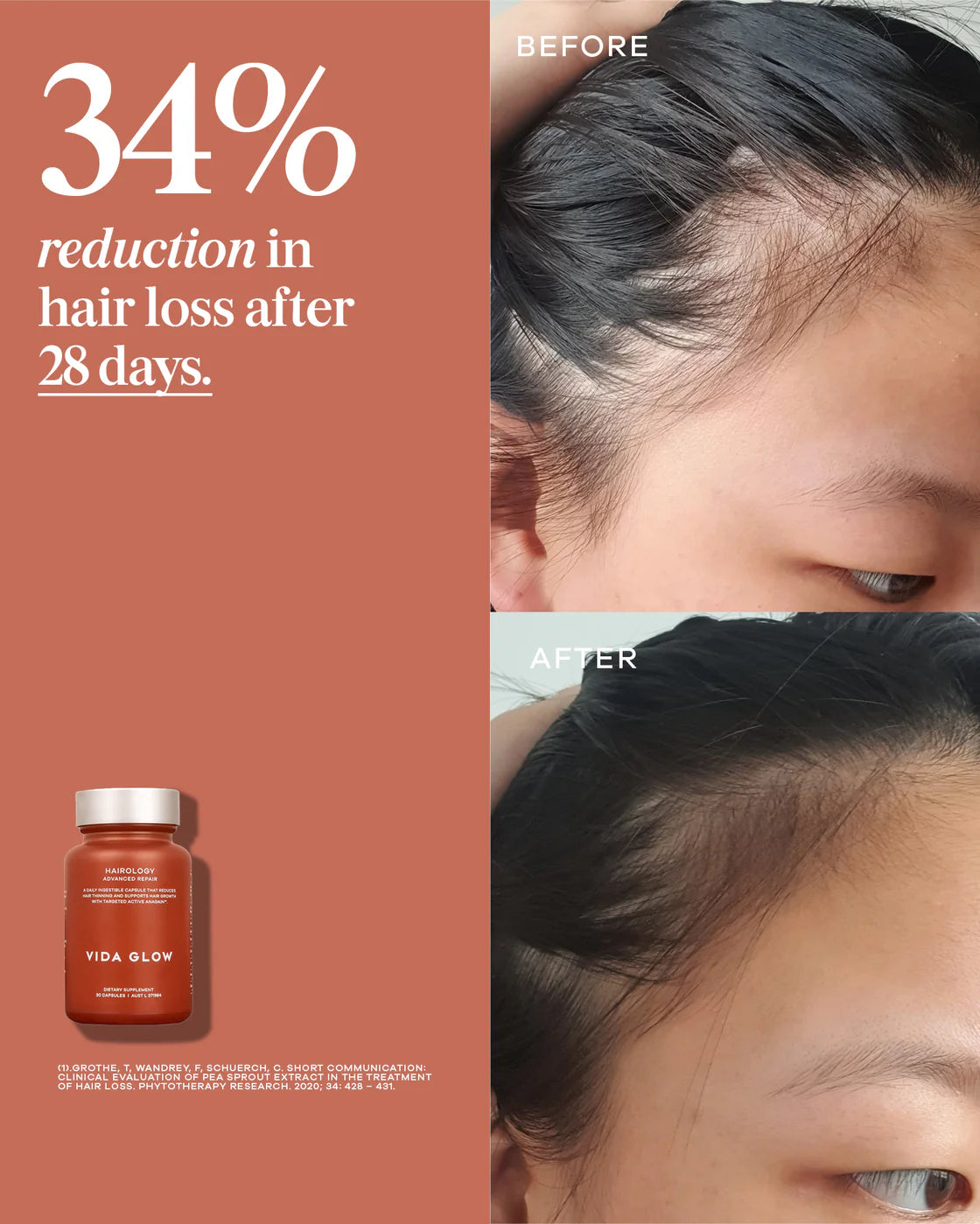 Vida Glow Hairology™ - 30 capsules