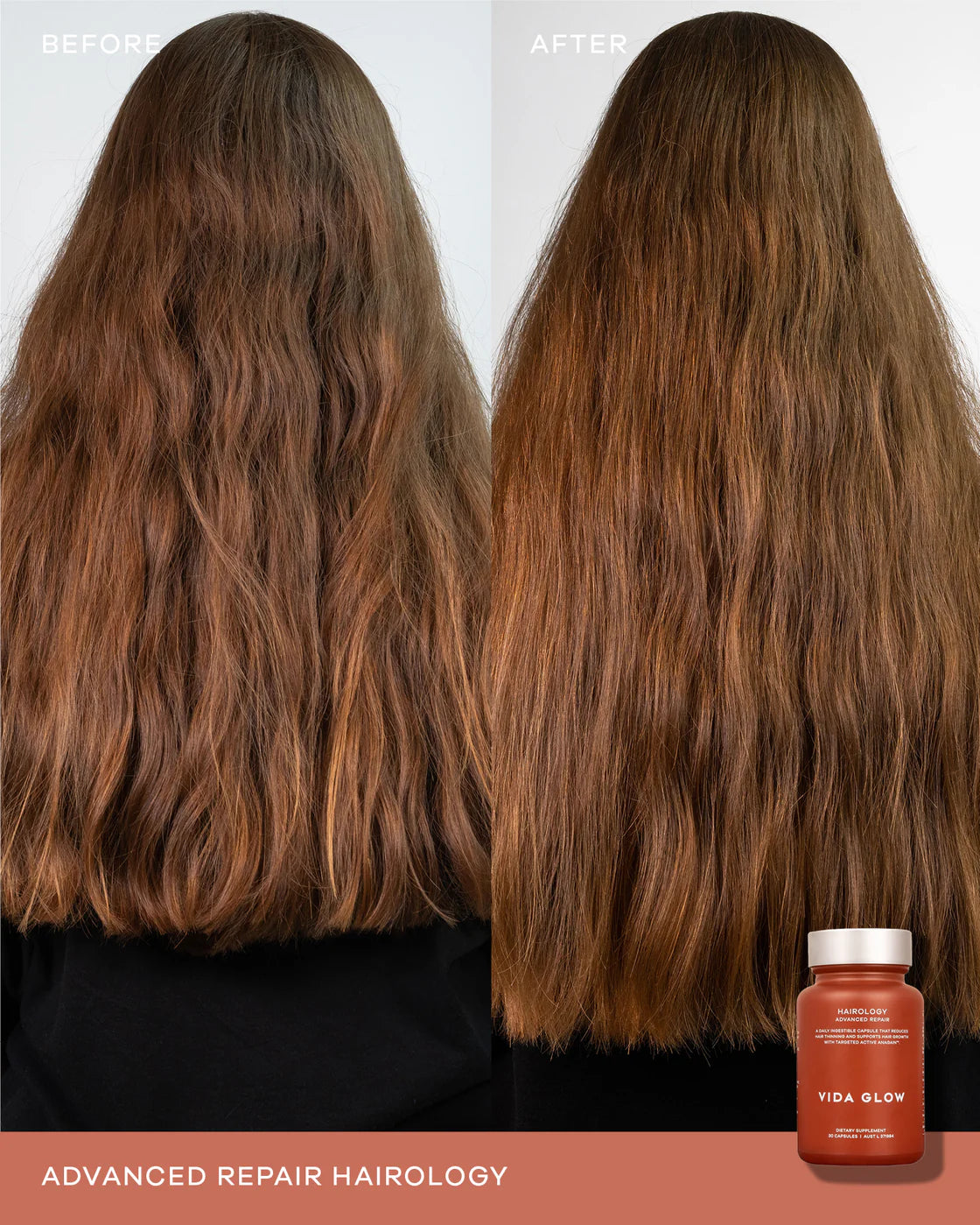 Vida Glow Hairology™ - 30 capsules